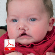 Schisis en borstvoeding PDF